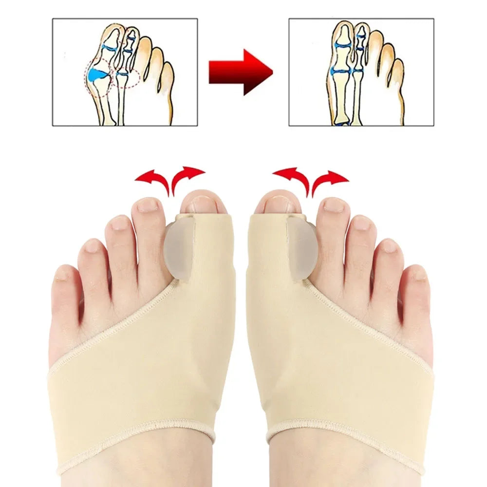 1Pair Toe Separator Bunion Corrector Toe Brace Orthopedic Hallux Valgus Relief Bone Thumb Adjuster Correction for Men and Women