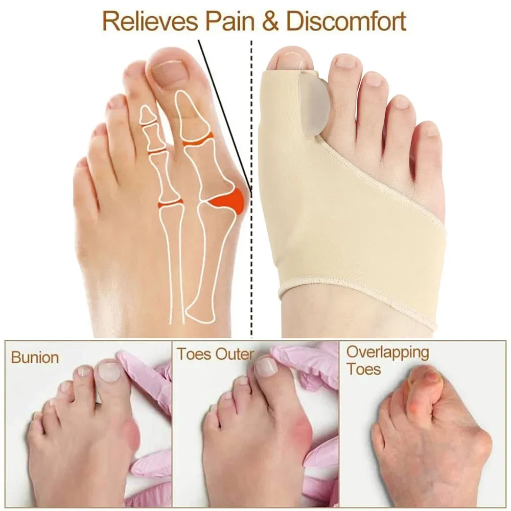 1Pair Toe Separator Bunion Corrector Toe Brace Orthopedic Hallux Valgus Relief Bone Thumb Adjuster Correction for Men and Women